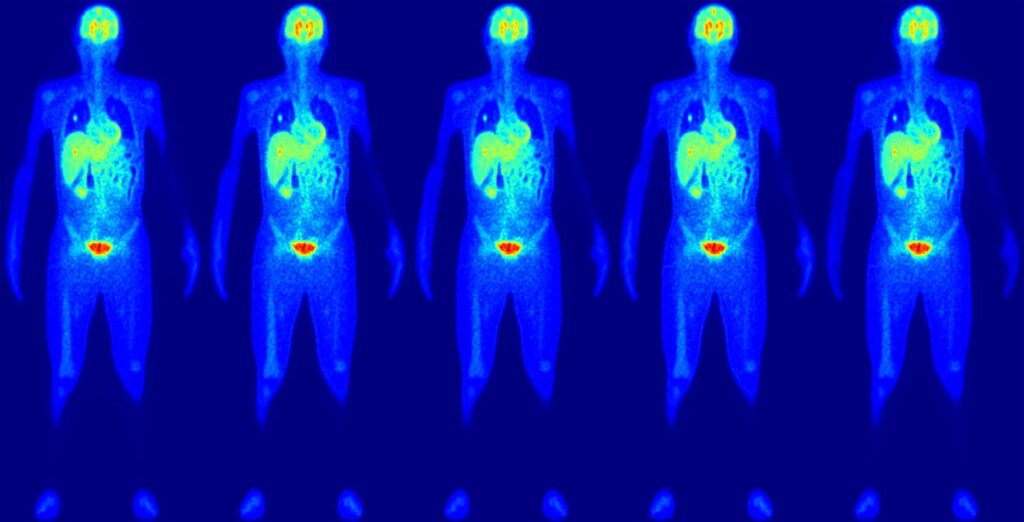 Example simulated PET images of anthropomorphic phantom