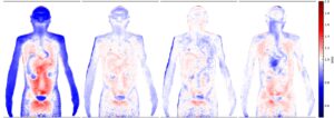 Quality of ML correction displayed based on anthropomorphic phantom/