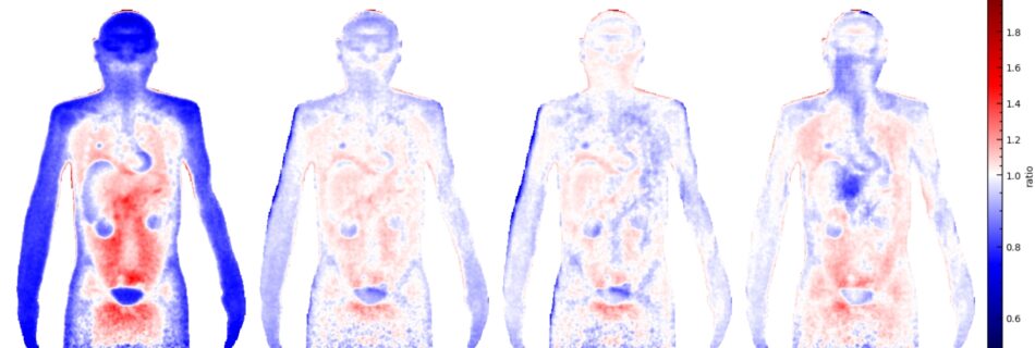 Quality of ML correction displayed based on anthropomorphic phantom/
