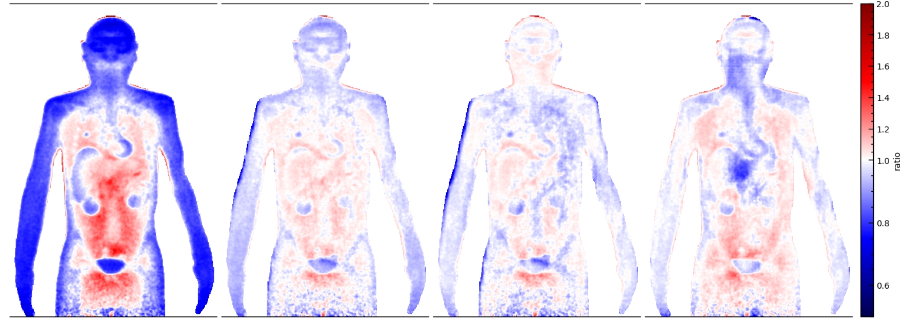 Quality of ML correction displayed based on anthropomorphic phantom/